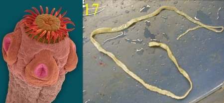 tapeworms Parasites